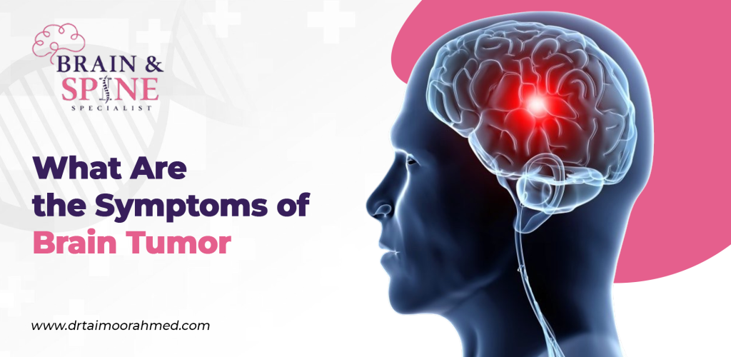 Symptoms of Brain Tumor