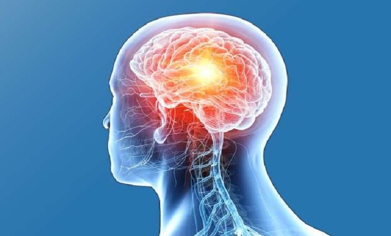 brain tumor treatment in Sialkot