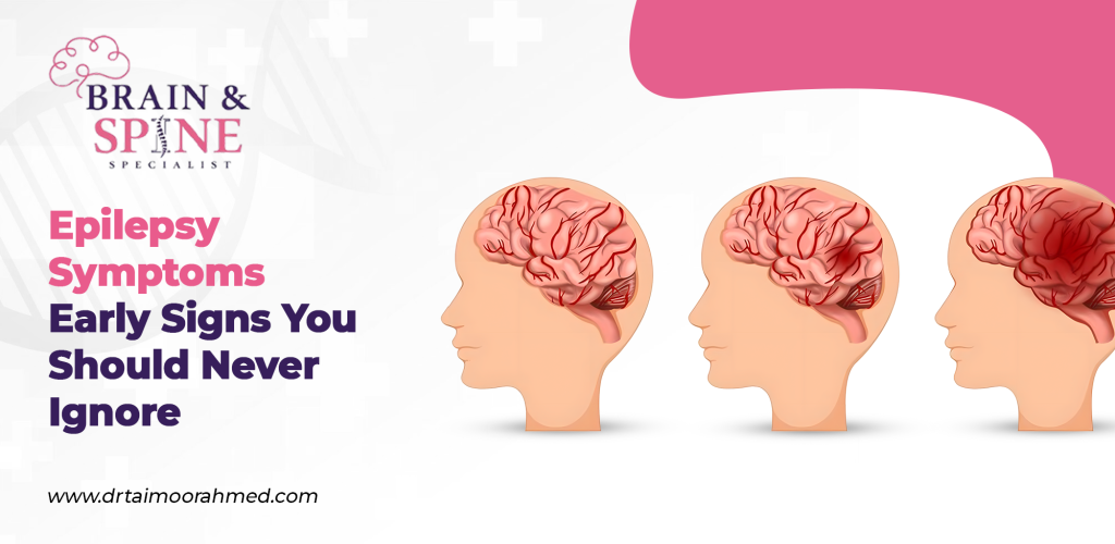 epilepsy symptoms